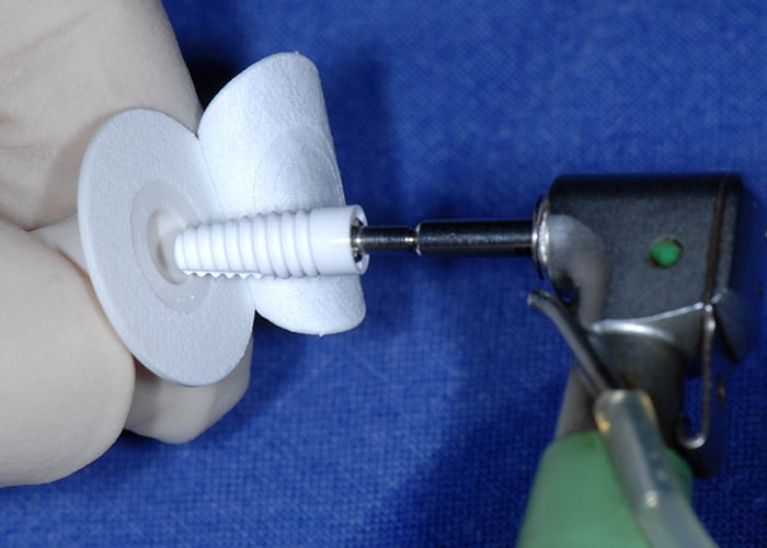 Neues zweiteiliges Nobel Pearl Implantat, tapered Design