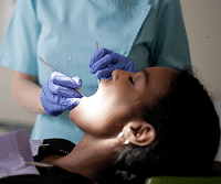 Professionelle Zahnreinigung zur Behandlung von Periimplantitis